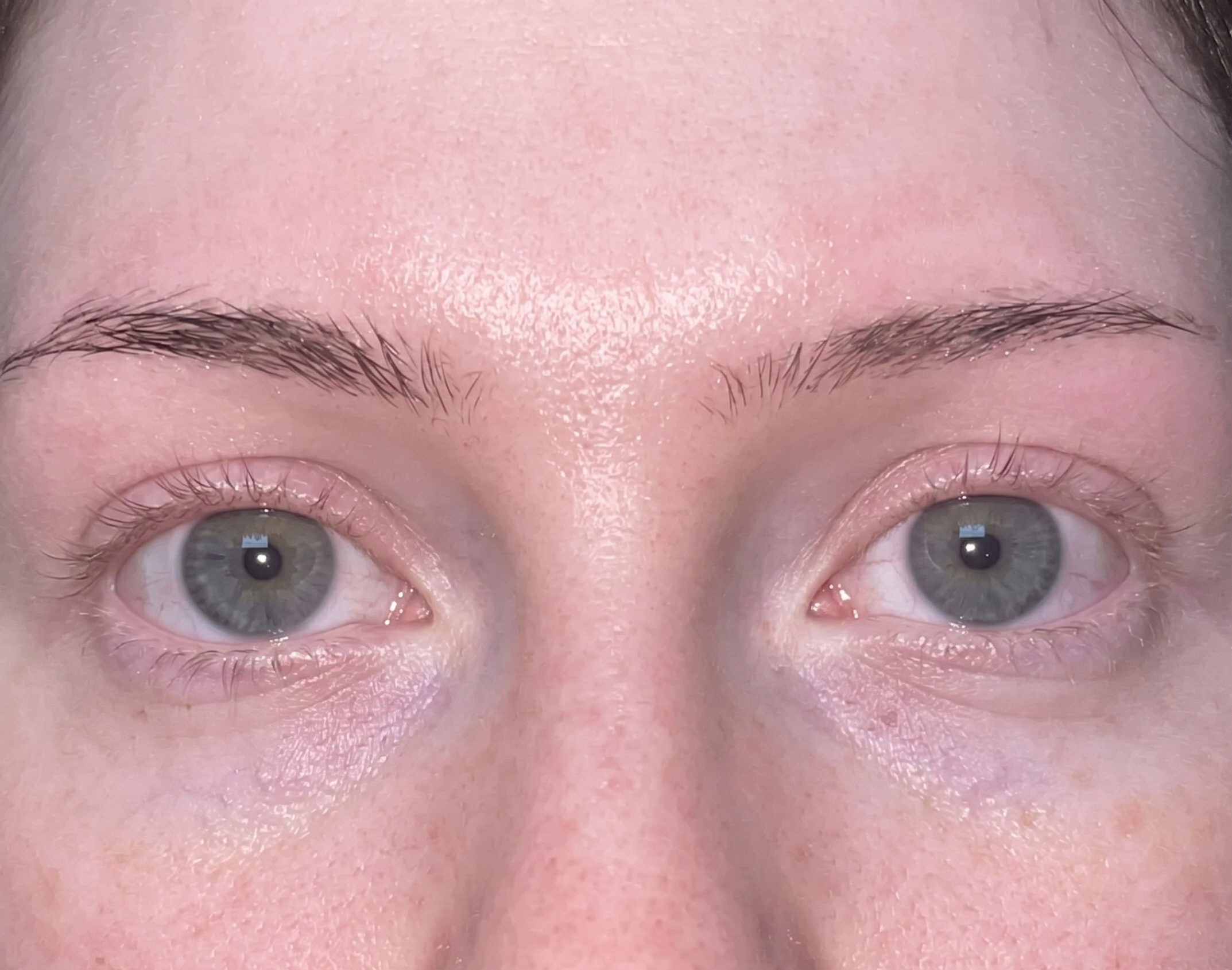 Prostaglandins in Lash Serums: What They Are, and the Side Effects Worth Knowing